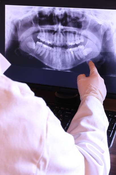 Best Emergency Root Canal Treatment in Kingston, WA